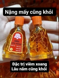 Dầu Viêm Xoang Gia Truyền tại Quảng Nam