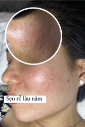 Chuyện dời non lấp biển là điều không thể xảy ra tại Quảng Nam