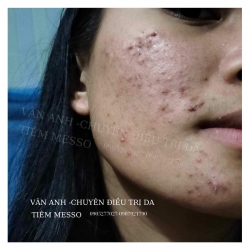 Đẹp sẵn là QUÊ rồi tại Quảng Nam
