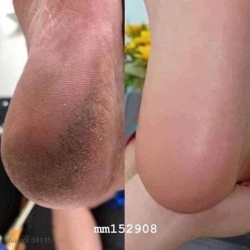 Chăm sóc đôi chân từ A đến Á tại Quảng Nam