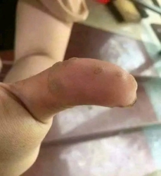 Em đã từng bị như này tại Quảng Nam