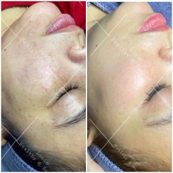 Điều trị dược mỹ phẩm tại Quảng Nam