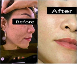 Lunie Spa - Vĩnh Điện tại Quảng Nam