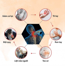 y tại Quảng Nam
