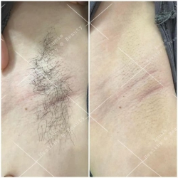 Lunie Spa - Điều trị dược mỹ phẩm tại Quảng Nam