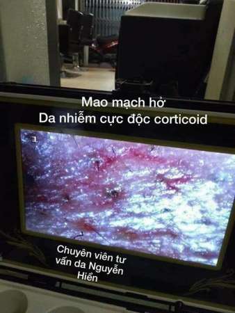 CHIỀU TỐI NAY HIỀN LẠI TIẾP TỤC CUỘC HÀNH TRÌNH SOI DA MIỄN PHÍ TẠI KCN ĐIỆN NAM ĐIỆN NGỌC tại Quảng Nam