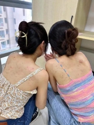 Mùa hè: Mụn lưng khiến bạn băn khoăn khi đi chơi? tại Quảng Nam