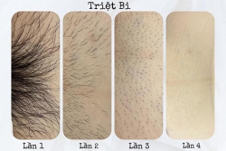 Dịch vụ điều trị dược mỹ phẩm tại Lunie Spa tại Quảng Nam