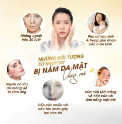 Tạm biệt làn da nám - chạm là mịn màng tại Quảng Nam