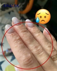 Ngứa càng gải càng ngứa tại Quảng Nam