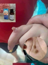 Dịch vụ chăm sóc da và điều trị mụn hiệu quả tại Quảng Nam