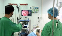 Nội Soi Tiêu Hóa Không Đau (Dưới Gây Mê) Và Những Điều Cần Biết tại Quảng Nam