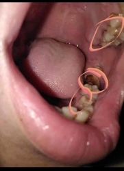 Bài viết về cách chữa sâu răng và hôi miệng bằng thuốc nam tại Quảng Nam
