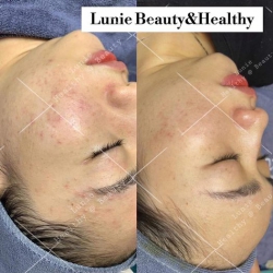 LUNIE SPA - Điều Trị Dược Mỹ Phẩm tại Quảng Nam