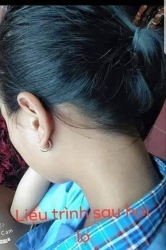 ch hàng tâm sự về thảo dược Lang ben và Hắc lào tại Quảng Nam