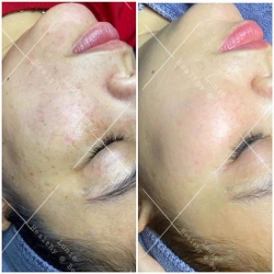 LUNIE SPA - Điều trị dược mỹ phẩm tại Quảng Nam