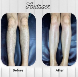 Dịch vụ điều trị dược Mỹ phẩm tại Quảng Nam
