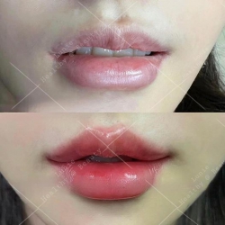 LUNIE SPA - ĐIỀU TRỊ DƯỢC MỸ PHẨM tại Quảng Nam