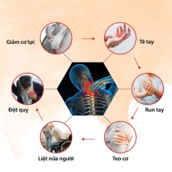 Phòng khám VLTL Tâm Trí với những phương pháp mới tại Quảng Nam