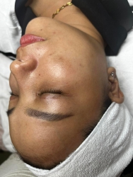 Ai còn nhớ ca mua thuốc về tự lột hơm ạ tại Quảng Nam