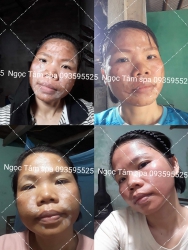 Chăm sóc da hiệu quả tại Ngọc Tâm spa tại Quảng Nam