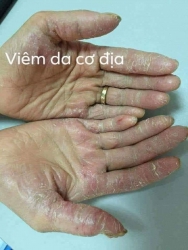 Chăm sóc sức khỏe và điều trị các vấn đề ngoại da tại Quảng Nam