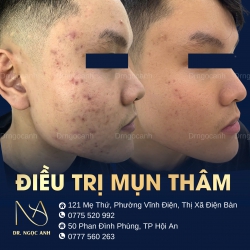 Chăm sóc da hiệu quả tại Thẩm mỹ viện Hương Đan tại Quảng Nam