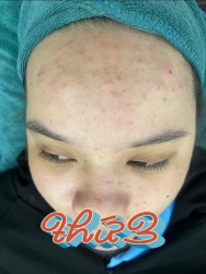 Chăm sóc da mặt tại nhà tại Quảng Nam