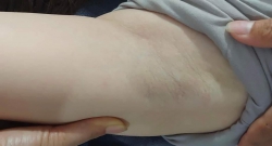 TRỌP GÓI ĐỂ MÙA HÈ THƠM THO SẠCH SẼ KHÔNG PHẢI NHỔ WAX NỮA tại Quảng Nam