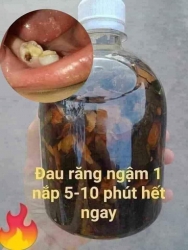 Tư vấn và chia sẻ liệu pháp trị sâu răng và vấn đề liên quan tại Quảng Nam