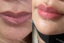 Bí quyết Môi xinh trong trẻo hồng tựa baby, thu hút mọi ánh nhìn là đây tại Quảng Nam