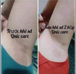 Mỹ Phẩm Nguyễn Hiền chính hãng - Hiệu quả cao tại Quảng Nam