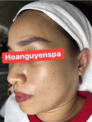 Làm Đều Màu Da tại Hoa Nguyen Spa tại Quảng Nam