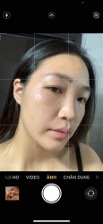 Rs Tox phục hồi chưa bao giờ làm chúng ta thất vọng tại Quảng Nam