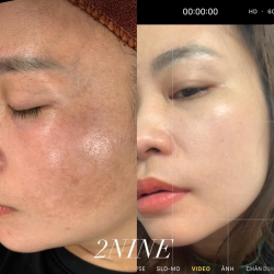 Chăm sóc da cùng sản phẩm chất lượng tại Quảng Nam
