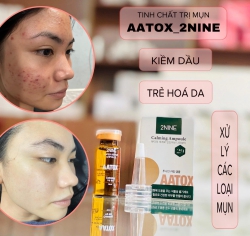 Chuyên trị các loại mụn cứng đầu - AATOX 2NINE tại Quảng Nam