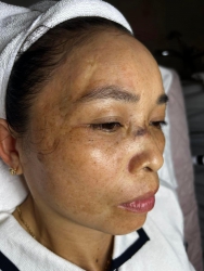 Còn nợ chị muôn vàng lời hứa. Nợ chị 1 làn da tựa hoa tại Quảng Nam