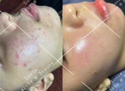 ch nhé! tại Quảng Nam
