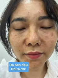 Từ xa da vẫn đẹp nhen, Chỉ cần đúng-đủ -đều là đẹp thôi tại Quảng Nam