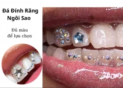 Răng trắng xinh - Lưng lịnh mời khung hình tại Quảng Nam